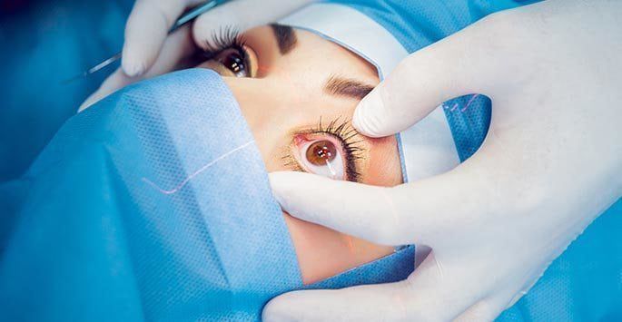  Laser Eye Surgery Works