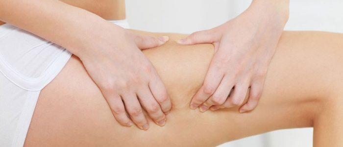 Cellulite Removal